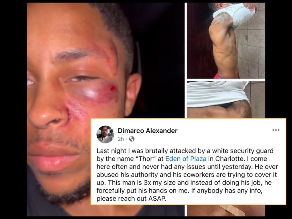 Man Says He Was Assaulted By Guard At Eden Of Plaza In CLT