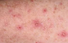 Nature’s Pharmacy:Surprising Remedies for Unusual Skin ...