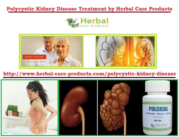10 Natural Remedies for Polycystic Kidney Disease - Herbal Care Products - Blog