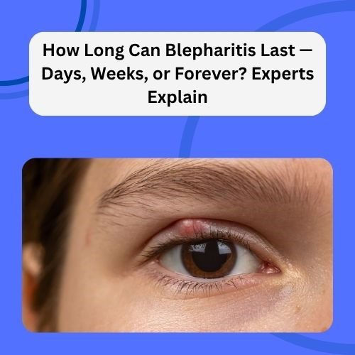How Long Can Blepharitis Last — Days, Weeks, or Forever? Experts Explain - Herbal Care Products - Blog