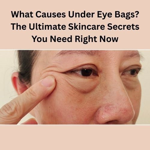 What Causes Under Eye Bags? The Ultimate Skincare Secrets You Need Right Now - Herbal Care Products - Blog