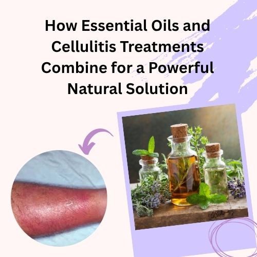 How Essential Oils and Cellulitis Treatments Combine for a Powerful Natural Solution - Herbal Care Products - Blog