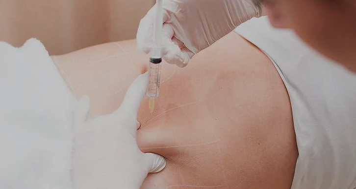 Fat Dissolving Injection | Non-Surgical Fat Reduction Treatment