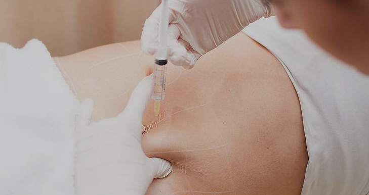 Fat Dissolving Injections: A Revolutionary Way to Target Stubborn Fat - Blog Planet