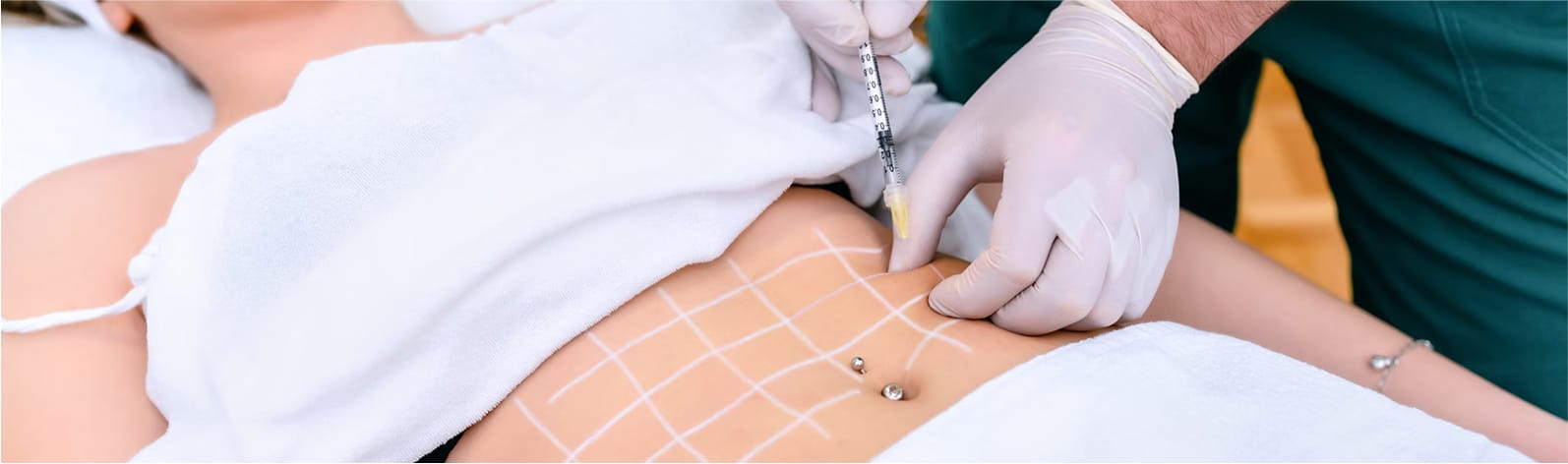 Lemon Bottle Fat Dissolving Injection - SlimSpa