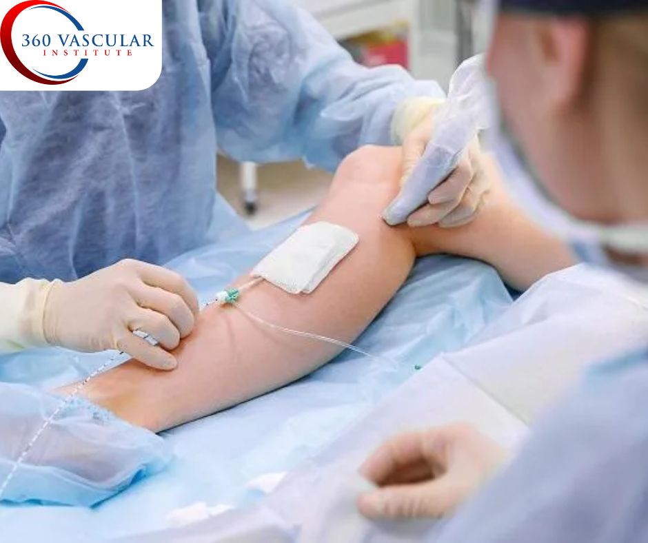 Top Vascular Care in Columbus: Interventional Radiology and Surgery by Dr. Sudi – 360 Vascular Institute