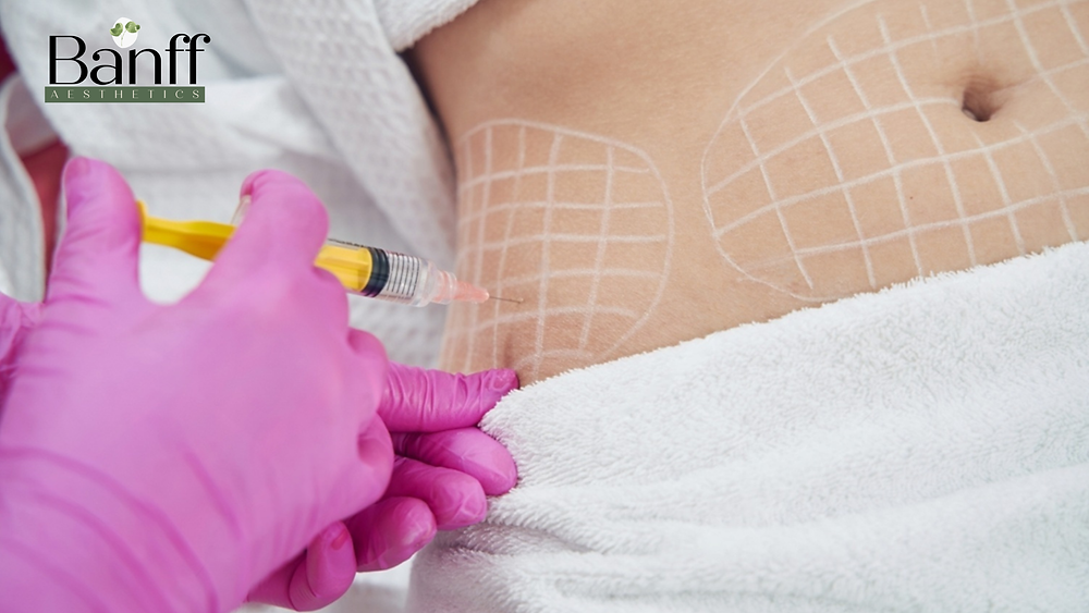 Do Fat Dissolving Injections Really Work Permanently?