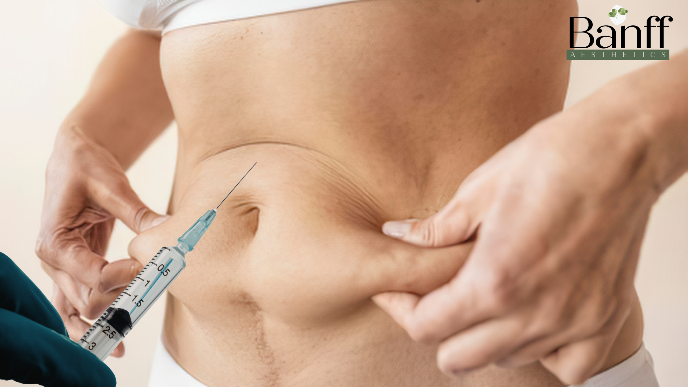 What Are Fat Dissolving Injections in Toronto and Do They Really Work? – Site Title