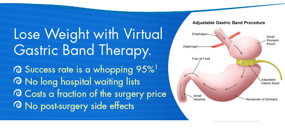 hypnotic gastric band