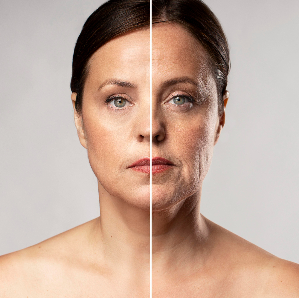 Face Lifting Treatment for Firmer, Youthful Skin