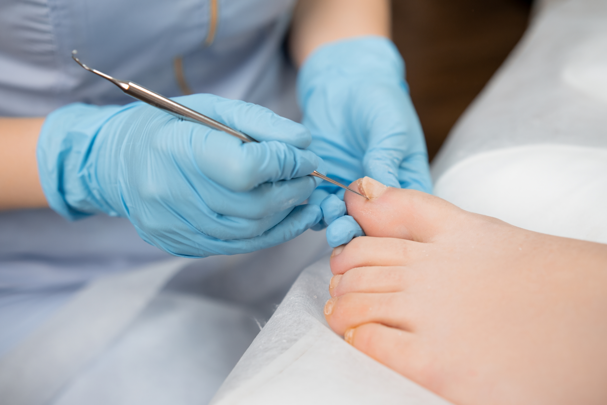 Common Foot Problems in Diabetic Patients and How a Podiatrist Can Help - kataberita.net