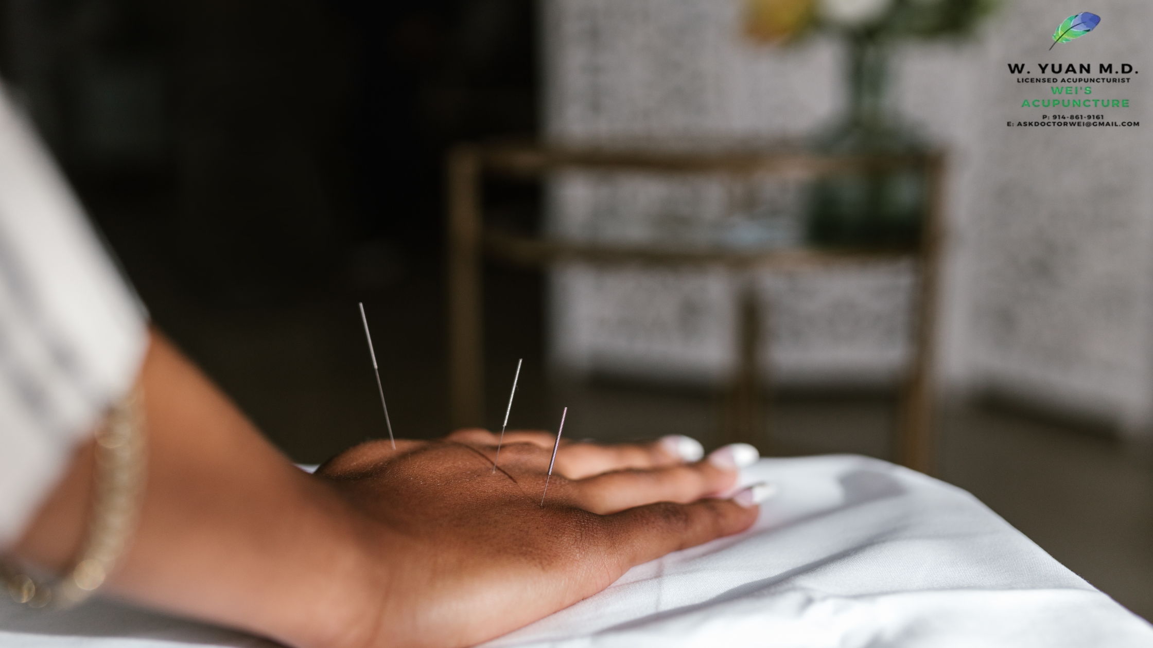 Natural Headache Relief with Acupuncture in Grand Central Terminal, NY – Site Title