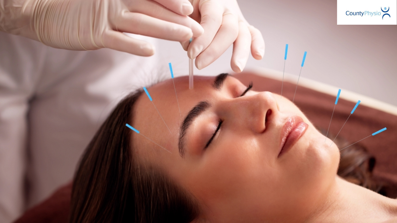 Acupuncture Treatments in Musselburgh, Prestonpans & Tranent