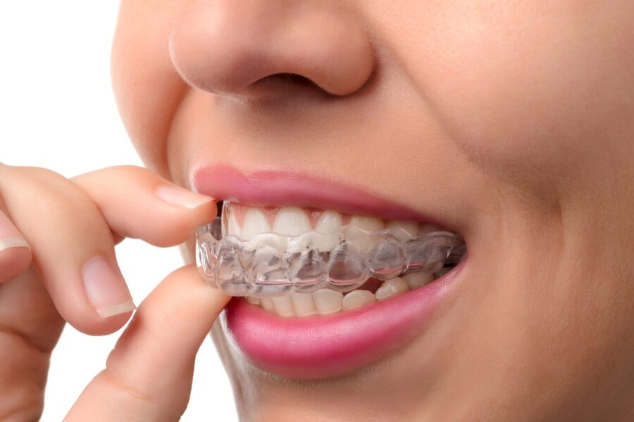 Invisalign Dentistry | Straighten Your Smile in Oxnard