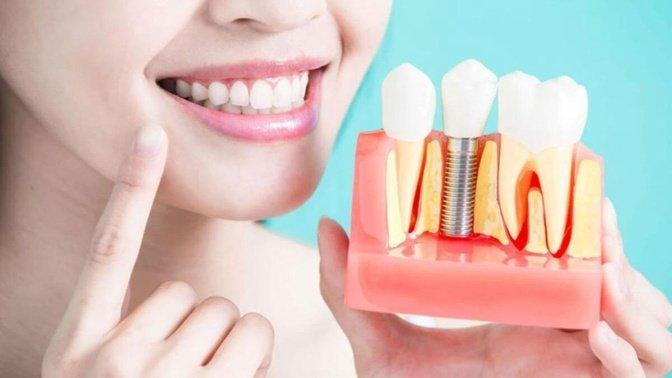 Dental Implant Recovery Tips for a Faster and Healthier Healing Process | Articles | Duluthimplant Dentistry | Gan Jing World - Technology for Humanity | Video & Movie Streaming