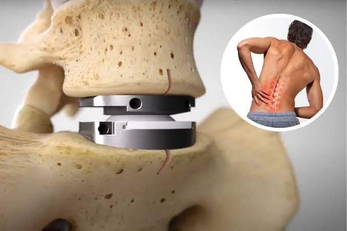 When Should You See a Neurologist or Spine Surgeon? | Brain & Spine Institute Texas – Global News – Discover What’s Happening Around You