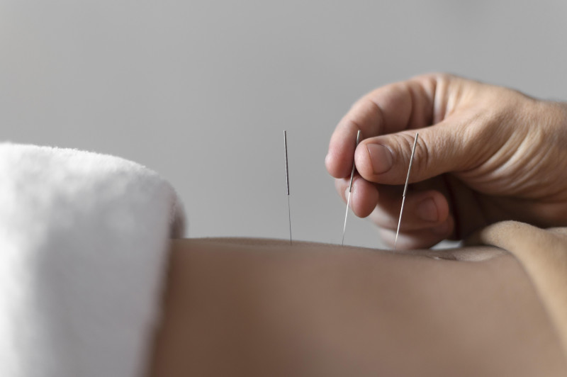Arthritis Acupuncture Treatment: A Natural Approach to Pain Relief and Better Well-Being: ext_6990529 — LiveJournal