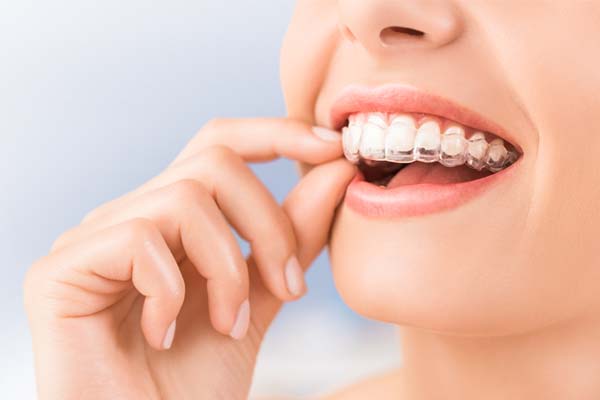 Orthodontist Canberra, Best Orthodontist near me