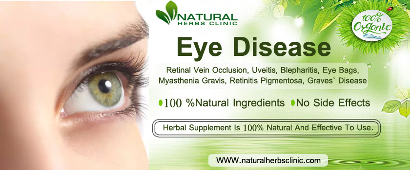 Natural Herbs Clinic - Herbal Alternative Medicine
