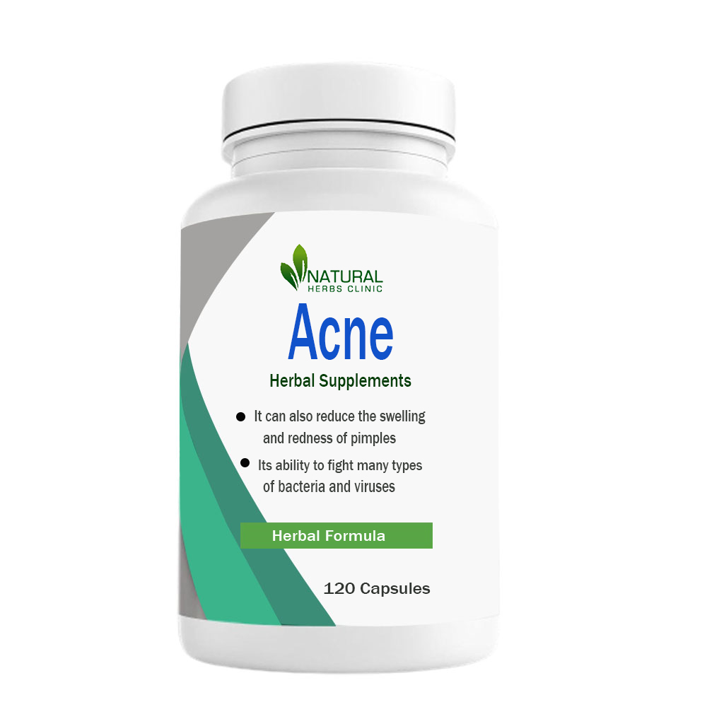 Herbal Treatment for Acne | Natural Herbs Clinic