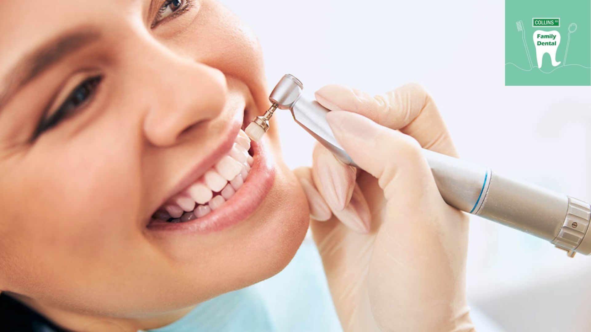 How Often Should I Get My Teeth Cleaned? – Collins Road Family Dental