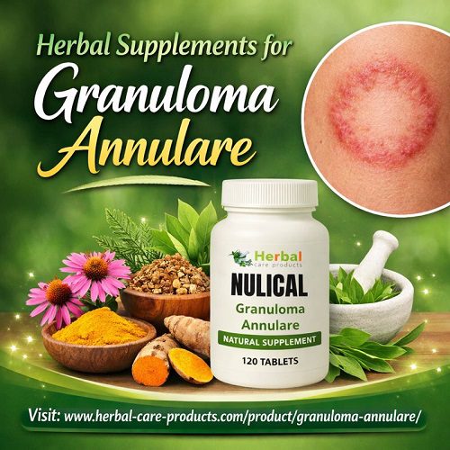 Herbal Supplements for Granuloma Annulare - Granuloma Annulare Natural Treatment