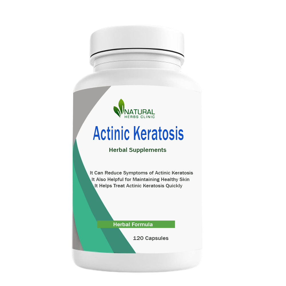 Herbal Treatment for Actinic Keratosis | Natural Herbs Clinic