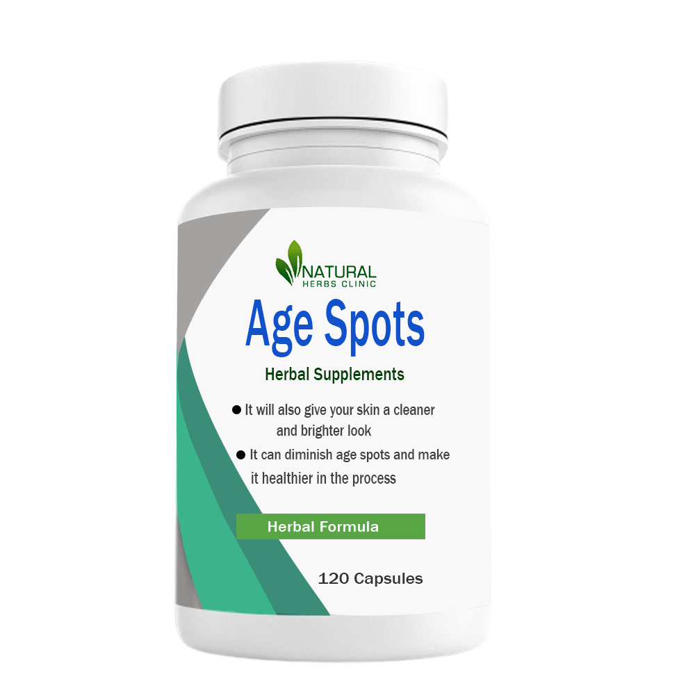 Herbal Treatment for Age Spots | Natural Herbs Clinic
