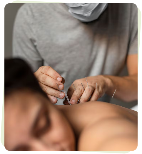 Traditional Chinese Acupuncture in West Island: Techniques and Benefits