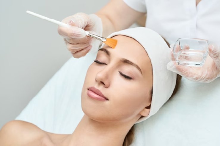 Chemical Peel Treatment in Srinagar Colony & Banjara Hills, Hyderabad | Keha Skin & Hair Clinic
