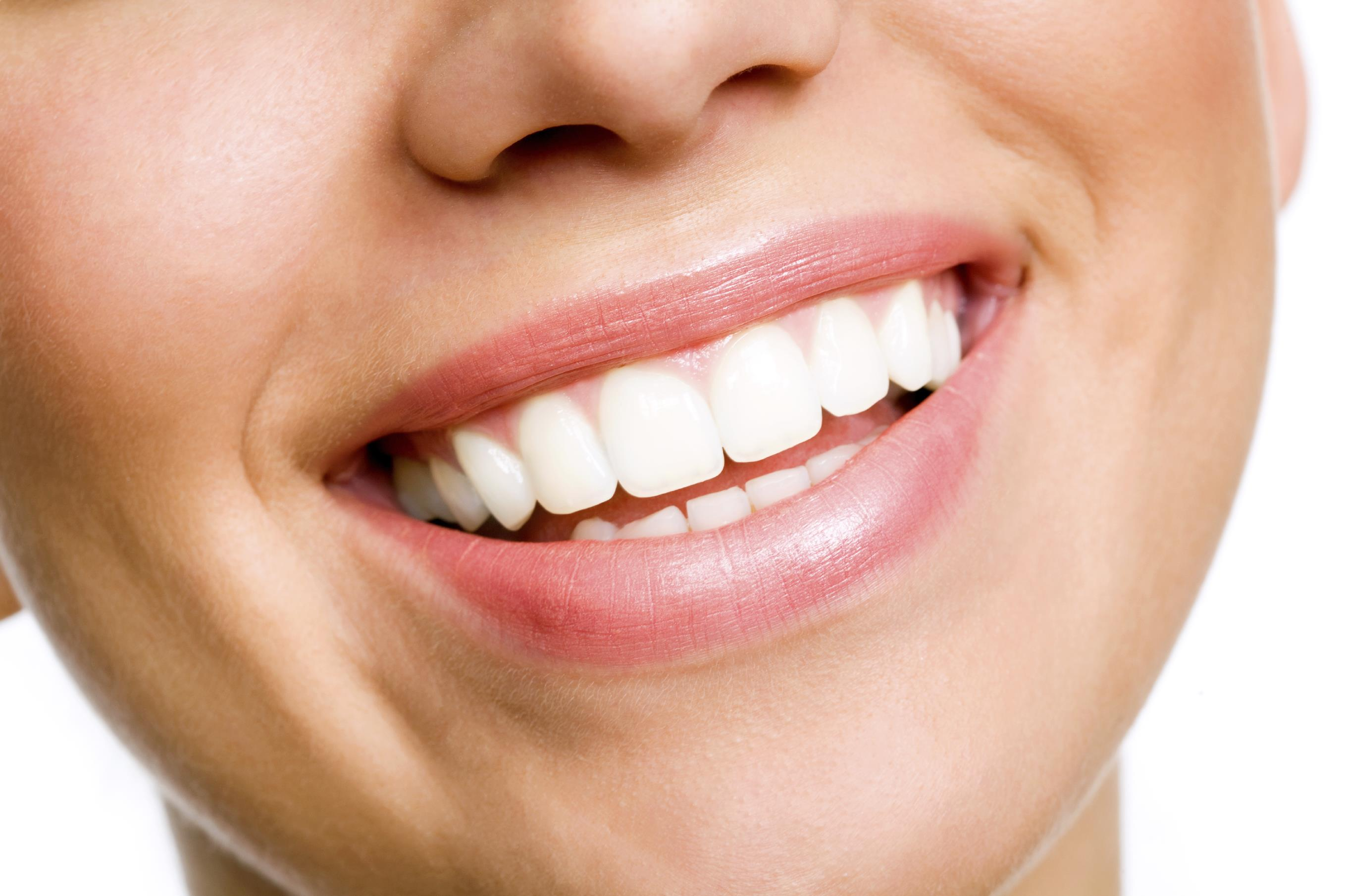 How Long Does Teeth Whitening Last and How to Maintain Results? – Collins Road Family Dental